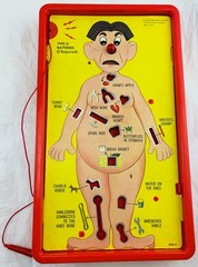 1965 Operation Game by Milton Bradley Complete/Works in Very Good Cond FREE SHIP
